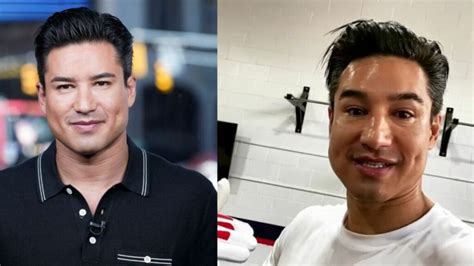 Holy Shit! What did Mario Lopez do to his face